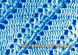 Образец ажурной вязки с бугорками